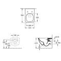 Подвесной унитаз Villeroy&Boch Venticello 4611RS01